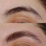 before/after before/after