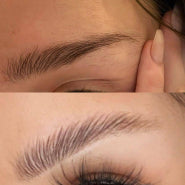 before/after before/after