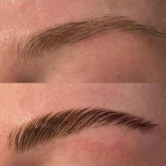 before/after before/after