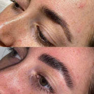 before/after before/after