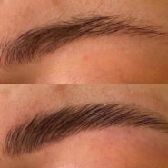 before/after before/after