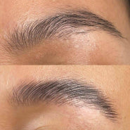 before/after before/after