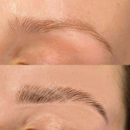 before/after before/after